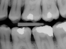 begley dental xray